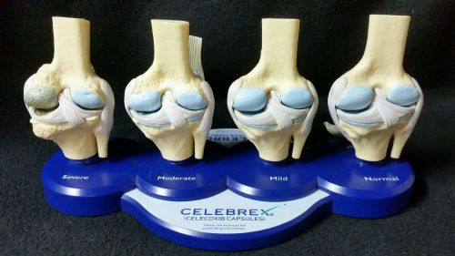 Celebrex Anatomical Model Human Knee Joints Arthritis Pathology 4 Knee Models