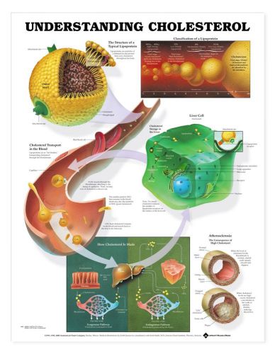 Understanding Cholesterol * Anatomy Poster * Anatomical Chart Company