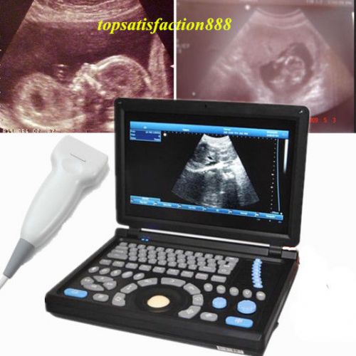 3d pc digital ultrasound scannermachine laptop main unit+7.5mhz superficia probe for sale