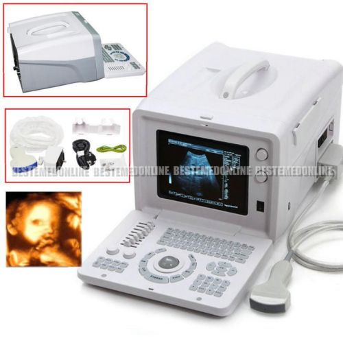 Portable ultrasound scanner,medical machine diagnosis system w 3.5m convex probe for sale