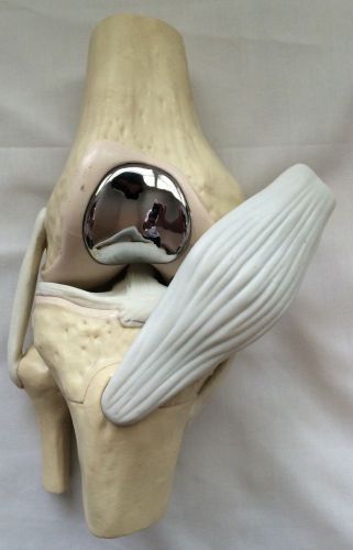 Arthrosurface Surgical Demonstrator Knee Demo Nice