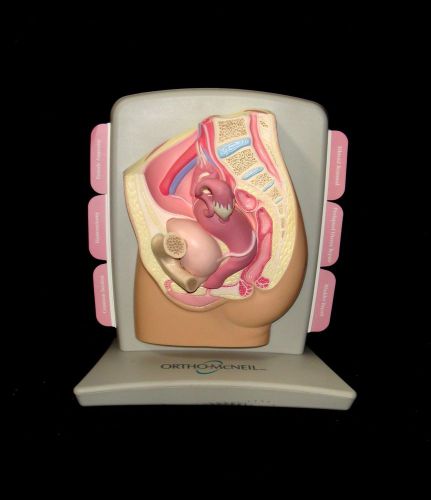 Female Pelvis Uterus Ovary Vagina Bladder Anatomical Model Patient Education