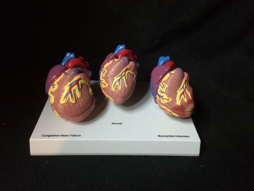 GPI #2550 3-Mini Heart Set Anatomical Model (6 Pieces)