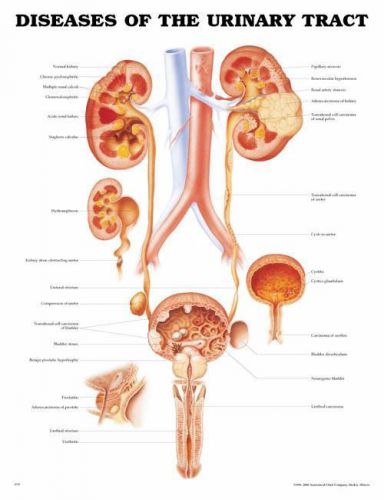 Diseases of the Urinary Tract * Urology * Anatomy Poster *Anatomical Chart Comp.