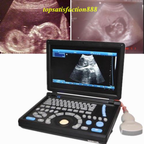 3D PC Digital Laptop 3.5Mhz abdominal Probe +Ultrasound ScannerMachine Main Unit
