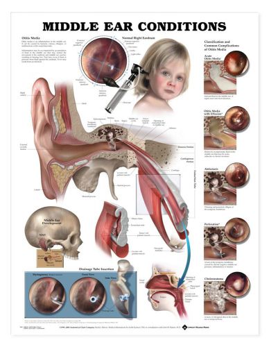Middle Ear Conditions Infection * ENT * Anatomy Poster * Anatomical Chart Co.