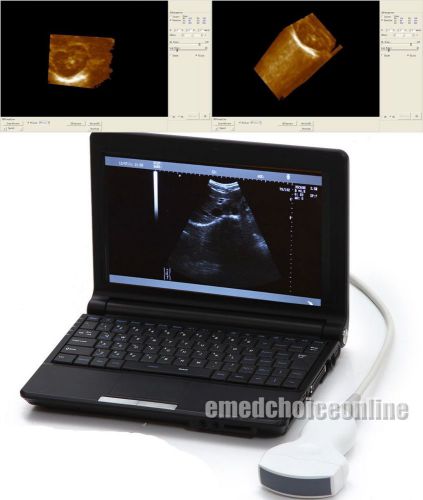 Free 3d new laptop full digital ultrasound scanner machine + 3.5mhz convex probe for sale