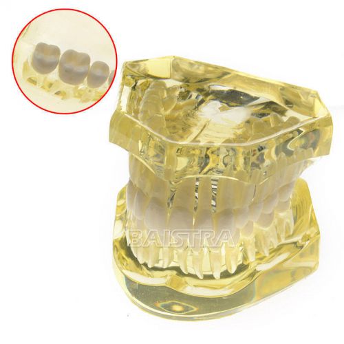 Dental best Model ADULT TYPODONT Model Teeth Removable Study Teaching 7006
