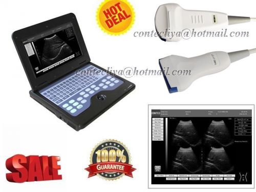 Hot big sale lcd full digital portable laptop ultrasound scanner with two probes for sale