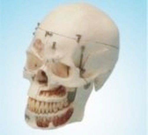 Human Dental Study Skull Model Teeth Medical Dental Study Anatomy High Quality