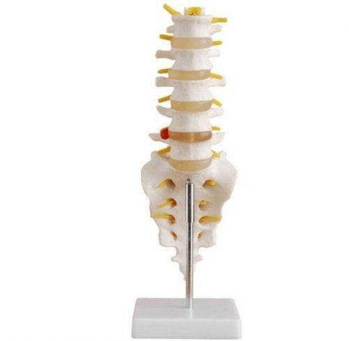 Life Size Lumbar Vertebrae with Sacrum &amp; Coccyx and Herniated Disc Joint Model