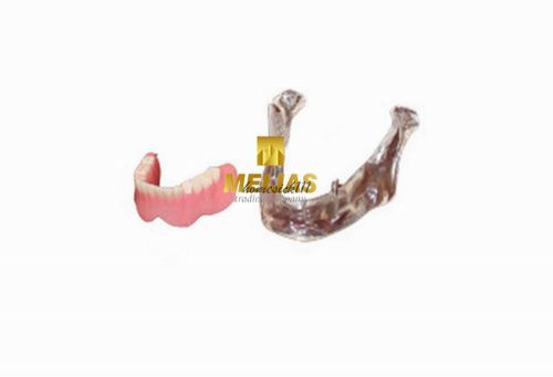 XINGXING Dental Study Teeth Implant Model of The Lower Jaw 2014b  HO