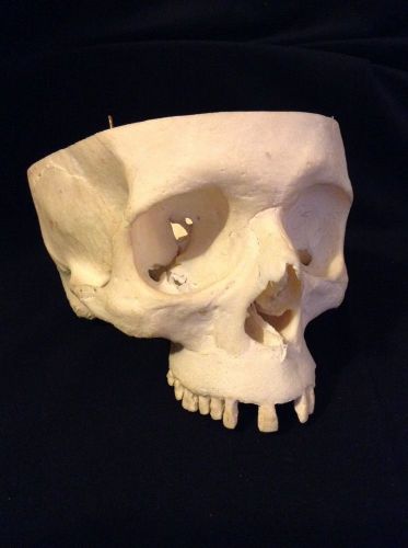 Genuine Real Human Skull Articulated for Medical Use