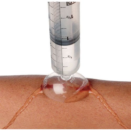 - igloo wound irrigation shield 25 pk for sale