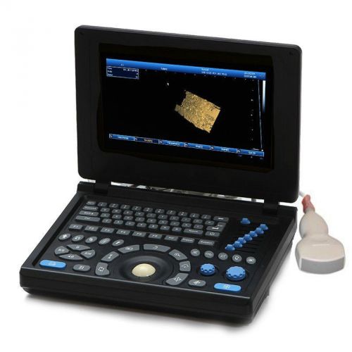 3d pc platform vga digital laptop notebook ultrasound scanner 3.5 convex probe for sale