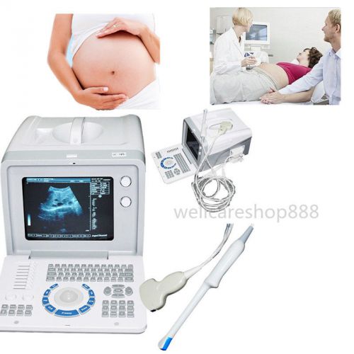 3D Digital Portable Ultrasound Scanner Machine convex +Transvaginal Probe doctor