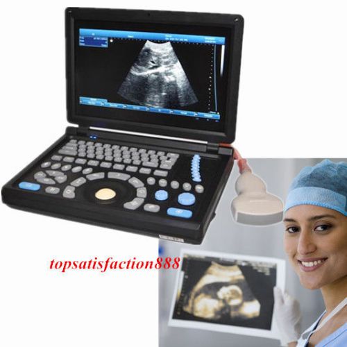3d pc notebook digital laptop ultrasound scanner with 3.5mhz abdominal probe for sale