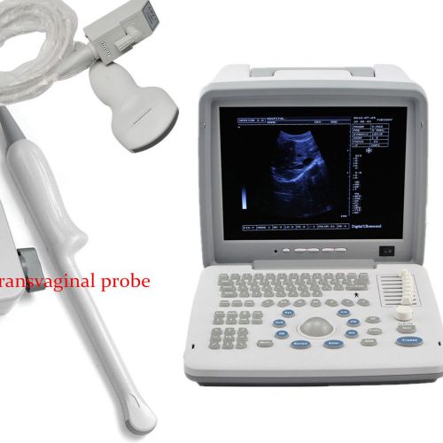 CAA  Portable Full Digital Portable Ultrasound Scanner Convex+Vaginal 2  Probes