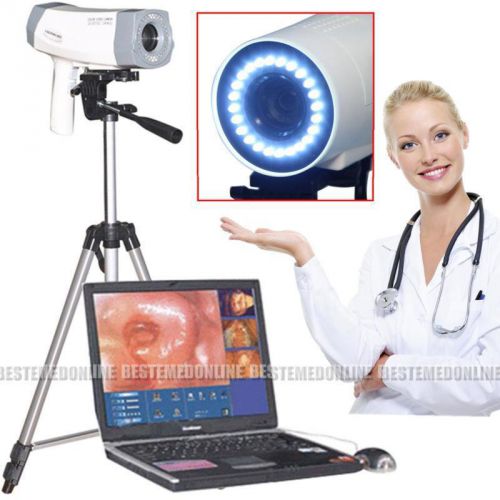 FDA Digital Video 800,000 SONY Camera Electronic Colposcope+Tripod + Software CE
