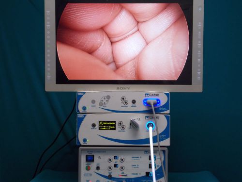 Conmed HD IM4000/ IM4120/ LS7700/ GS1002 vs Stryker 1188/1288/Storz Image 1 hub