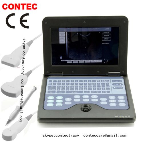 Digital Smart Laptop Ultrasound Scanner, B-Ultrasound Machine with 4 probes,CE