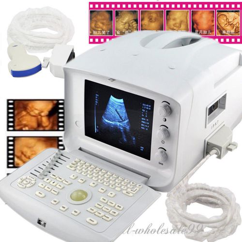 Ultrasonic SCANNER diagnostic Machine+Convex Probe pregnanacy Abdmen +3D SW*