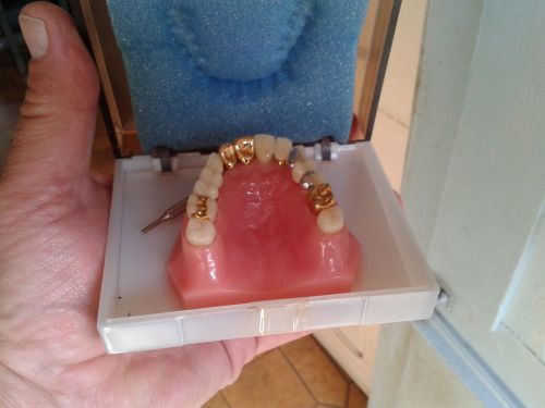 Dental demonstration model by Formadent- crowns,inlays, bridges, implants posts