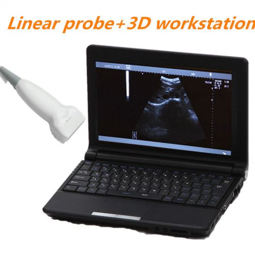 TFT Notebook Laptop Digital Ultrasound  Scanner + Linear Probe +3D workstation