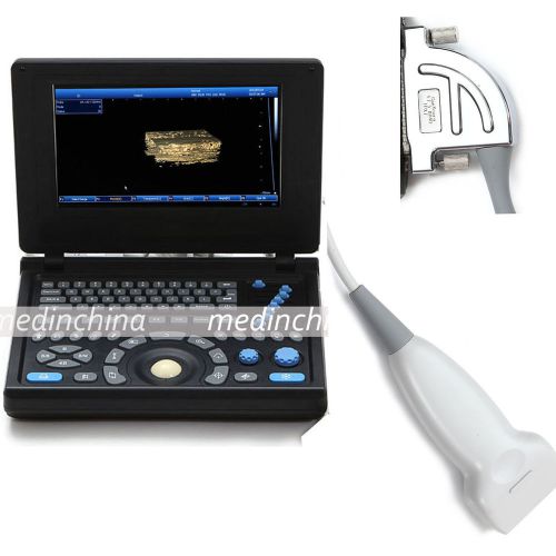 Build-in 3D Full digital Laptop Ultrasound Scanner PC based+ 7.5mhz Linear probe
