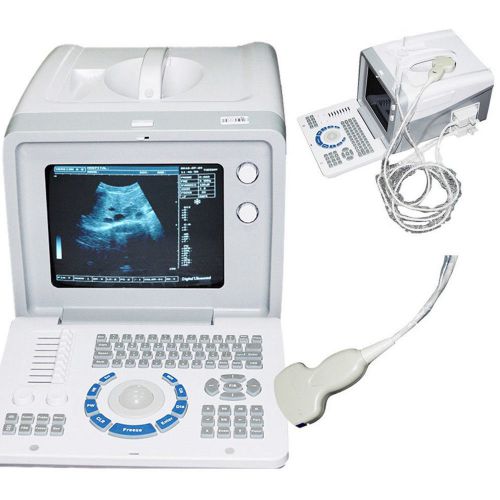 3d full_digital portable ultrasound scanner machine+linear probe fda certified#3 for sale
