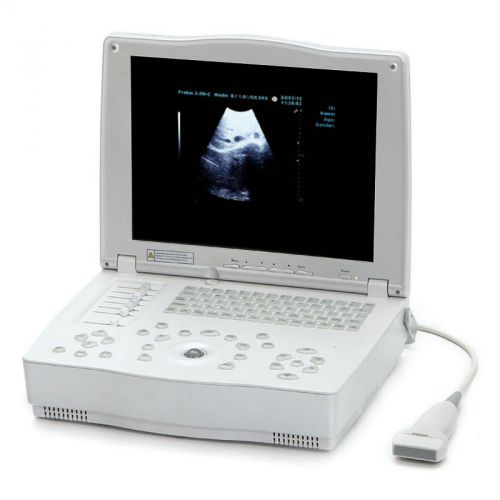 CA  10&#034;  Durable  Laptop Ultrasound Scanner/Machince with Convex  Linear 2 Probe