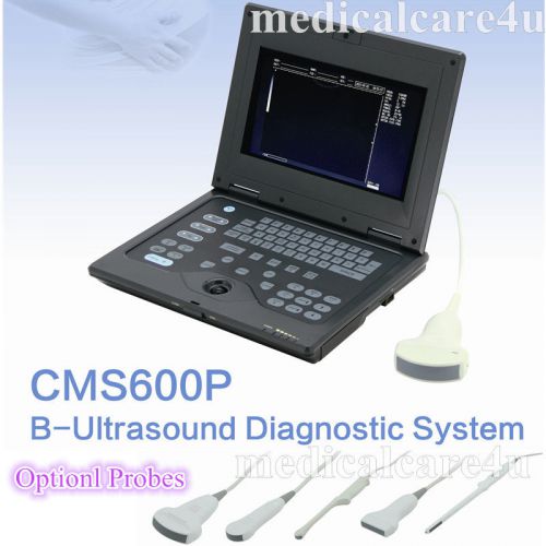 Human full digital laptop ultrasound scanner,3.5m convex probe,3 years warranty for sale