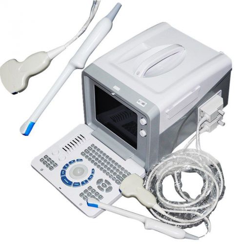 Portable digital ultrasound scanner machine linear probe+3d free shipping for sale