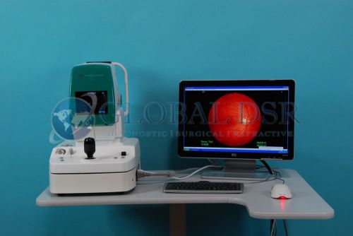 Kowa a-d mega 5 nonmyd non mydriatic fundus camera w/ power table for sale