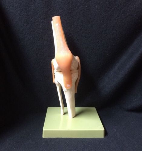 SOMSO NS50 Functional Knee Joint Anatomical Teaching Model on green base (NS 50)