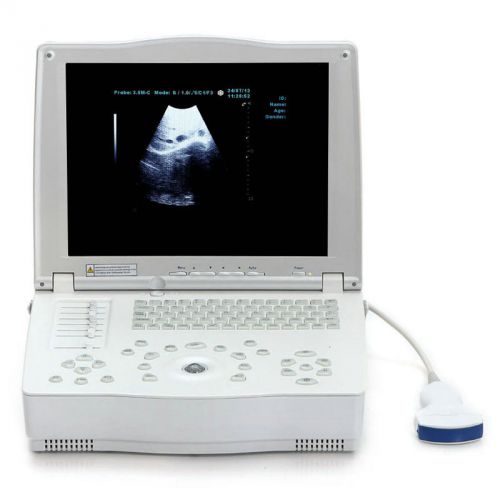 Ca  10&#034; laptop ultrasound scanner/machince with convex probe curved transducer for sale