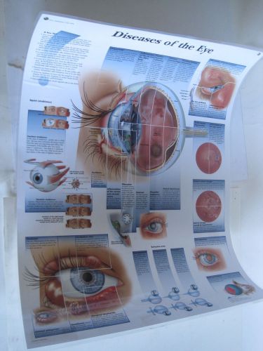 3B Scientific Glossy Paper Diseases of The Eye Anatomical Chart VR1231L NNB