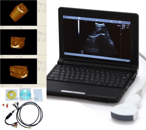 Digital Portable 3D SW Laptop Ultrasound machine Scanner system +convex probe