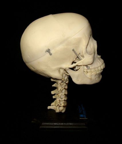 Medical Plastics Laboratory Human Skull Cervical Vertebrae Anatomical Model