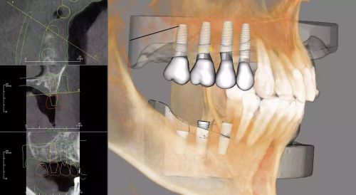 Invivo 5.3 by anatomage for sale