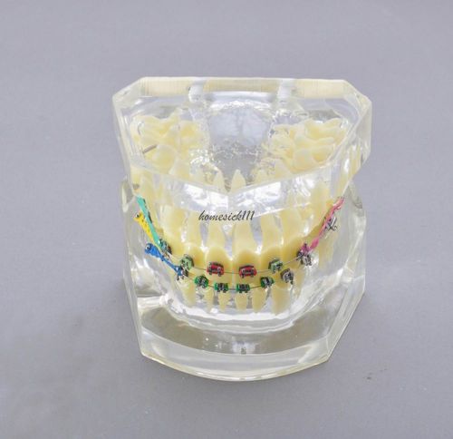 Xingxing orthodontic treatment study model with bracket and arch wire 3005-ii  h for sale