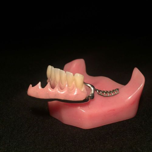 1980s Removable Metal Frame Work Tissue PARTIAL DENTURE Exam Model AMERICAN MADE