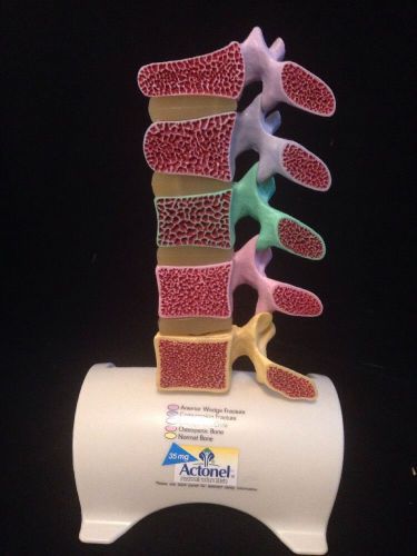 Vintage Spine Vertebral Column Pathology Anatomical Compression Model Take Apart