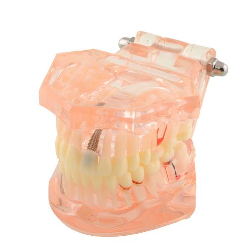 New High Quality Dental Removable Teaching Teeth Adult Children Typodont Model