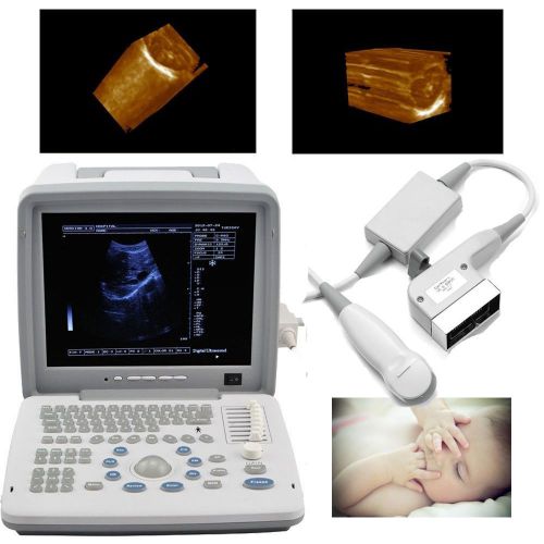 Full digital portable ultrasound scanner+micro-convex probe 5.0mhz+3d software for sale