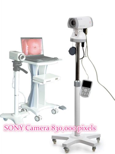 New digital sony camera electronic colposcope gynaecology+windows 7 software key for sale
