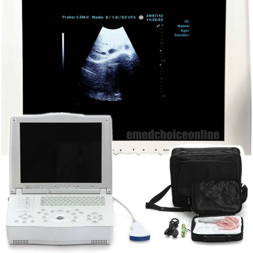 Fda full digital laptop 15-inch ultrasound scanner +convex probe + free 3d ce for sale