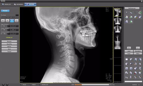 Kodak Orex PCCR Complete Digital Xray CR Veterinary Chiropractor