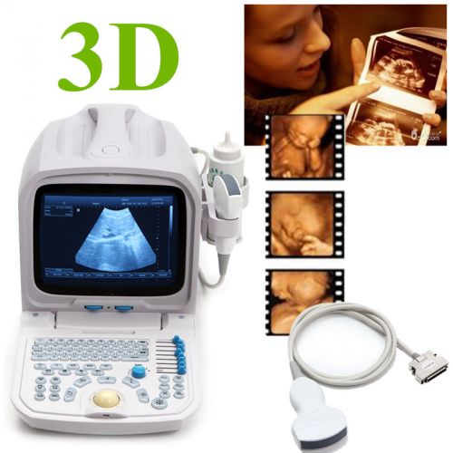 3d pc plateform based full digital portable ultrasound scanner+3.5mhz convex pro for sale