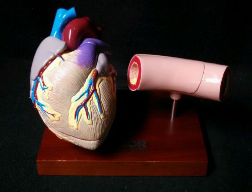 Vintage Heart and Artery Anatomy Anatomical Teaching Model